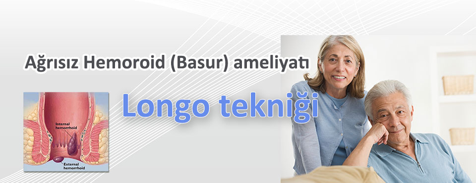 longo-hemoroid